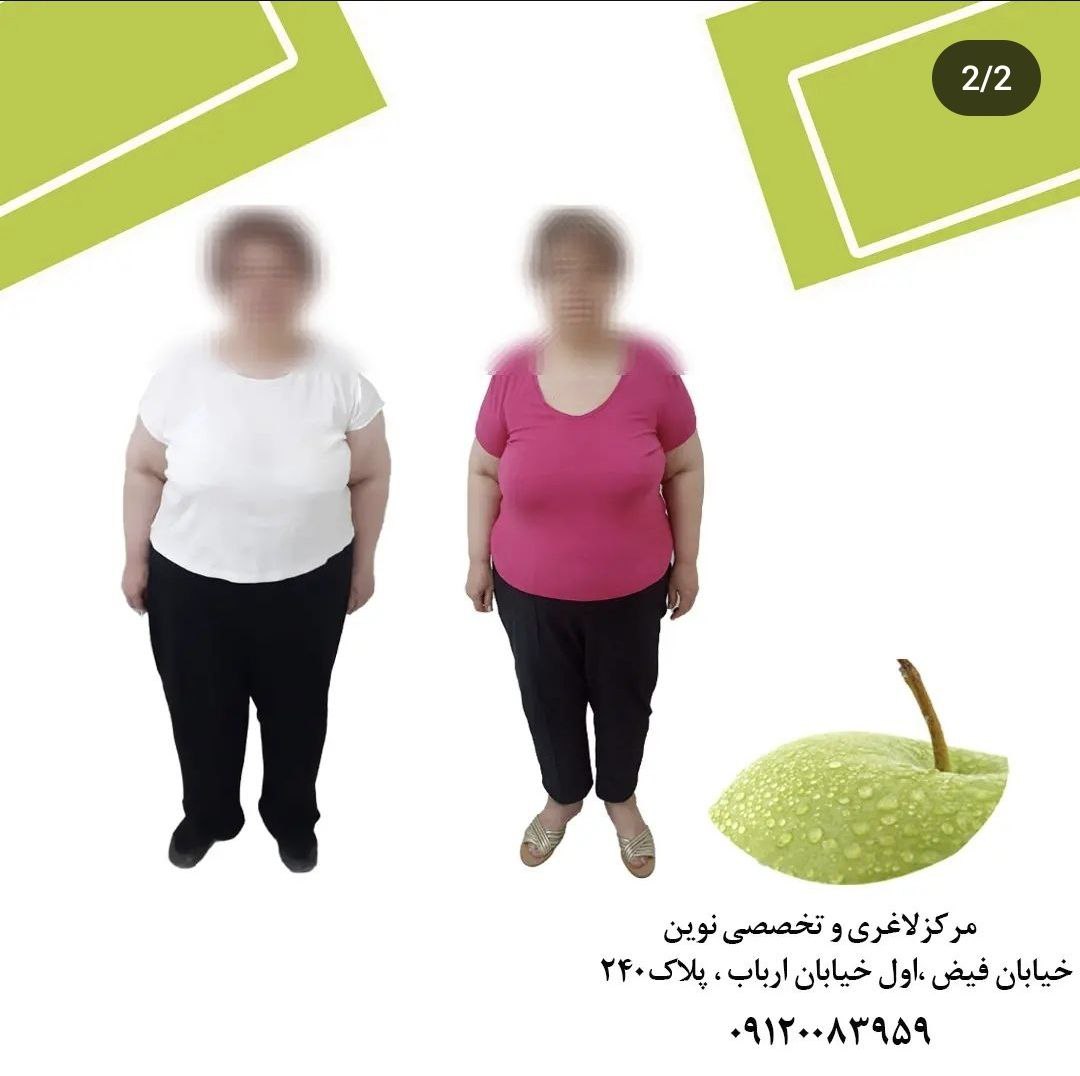نمونه کار های موفق لاغری