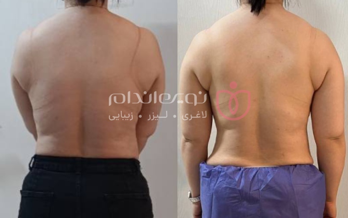 مجموعه زیبایی و لاغری نوین