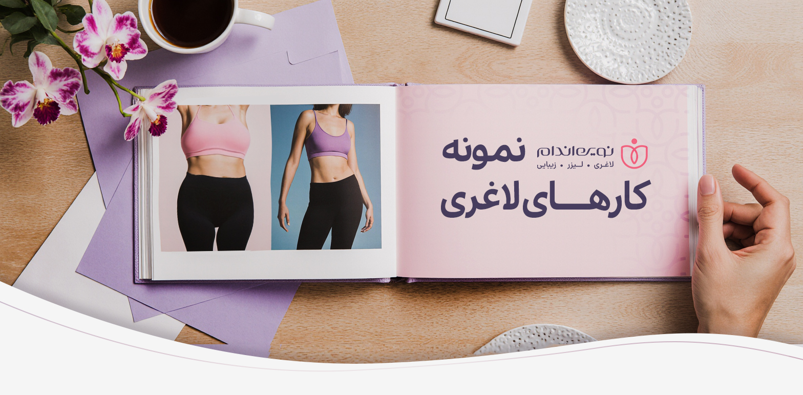 نمونه کار های موفق لاغری